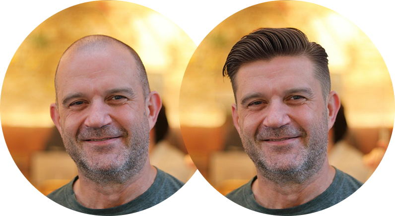 AI Surgery Simulator